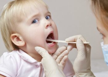 Вирусная инфекция - мононуклеоз у детей