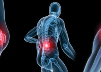 Артралгия: локализация