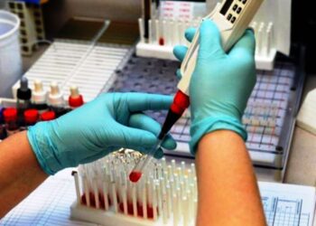 Метод диагностики по Вестергрену используют во всем мире