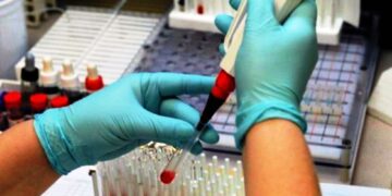 Метод диагностики по Вестергрену используют во всем мире