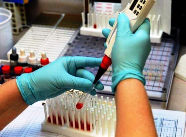 Метод диагностики по Вестергрену используют во всем мире