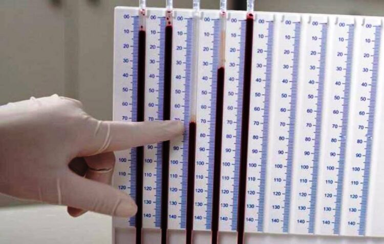 Причины отклонения показателей СОЭ от нормы имеют разную природу