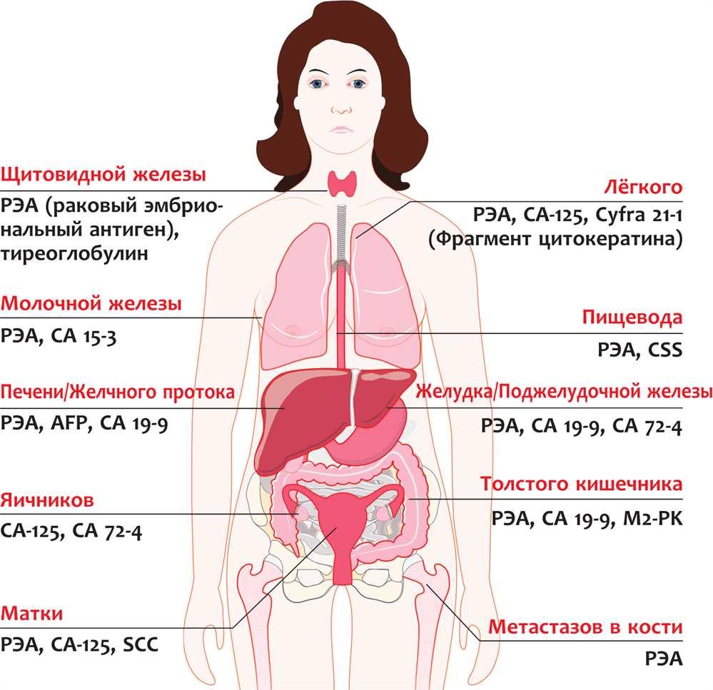 Са 125 значения. Онкомаркеры. Онкомаркеры схема. Онкомаркеры локализация опухоли. Онкомаркеры для женщин.