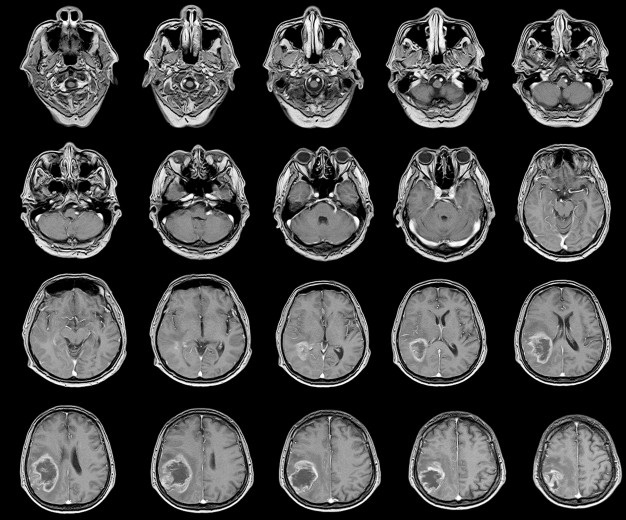 Изображения, получаемые в результате МРТ головного мозга