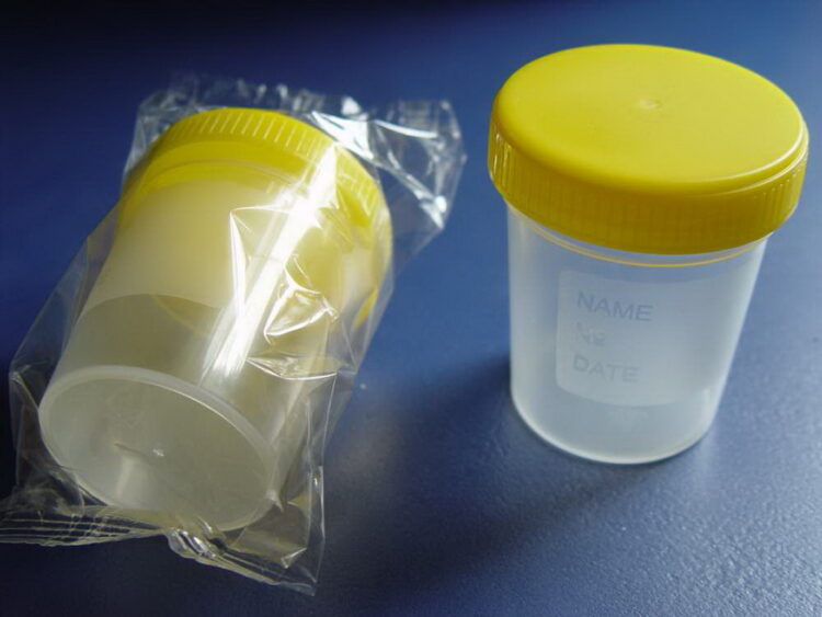 Анализы мочи расскажут о наличии воспалительных процессов