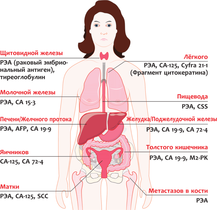 Специфические онкомаркеры, указывающие на злокачественные процессы определенной локализации