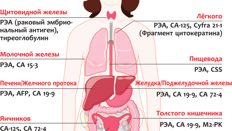 РЭА как онкомаркер злокачественных новообразований